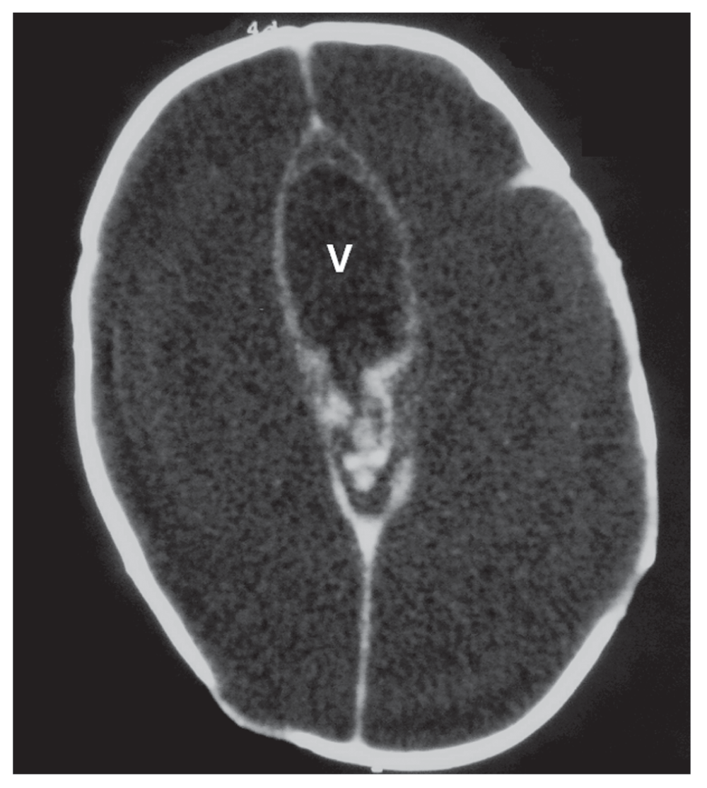 28ed5472-2205-446a-a894-9f52c03eaf21_figure3.gif