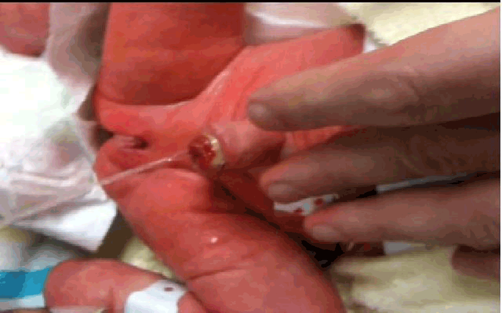 17671d62-8ef8-4b53-906f-7c09279502d5_figure2.gif