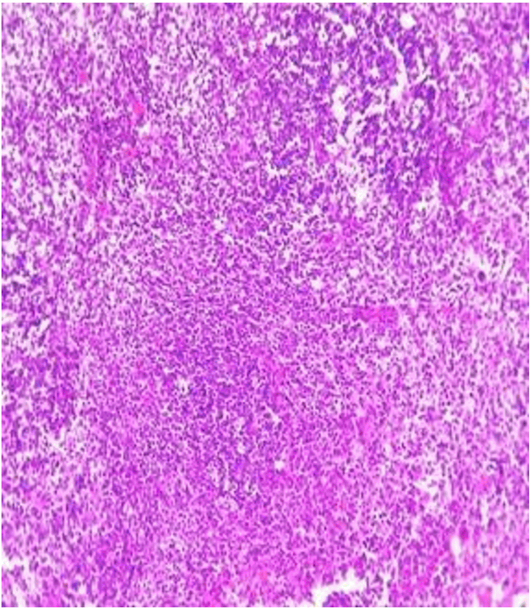 440eb626-bd32-4caa-b3cf-bf6f09d74d6c_figure15.gif