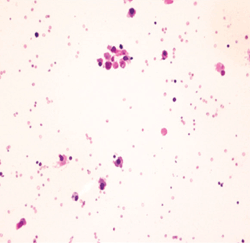 cc93ed57-dfa4-4fd4-b279-e4038f666571_figure2.gif