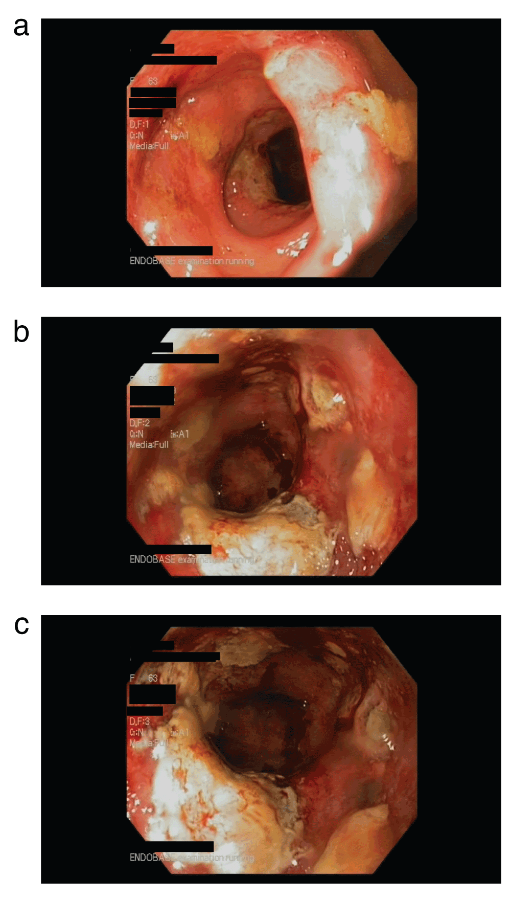 f13b620b-414f-4e27-aeb3-6a9615f04993_figure1A.gif