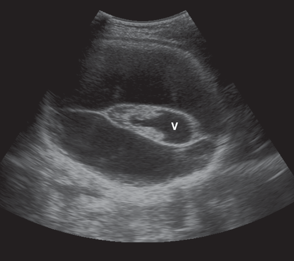 aba023fb-a007-425d-b431-aa1bfad1309f_figure1.gif
