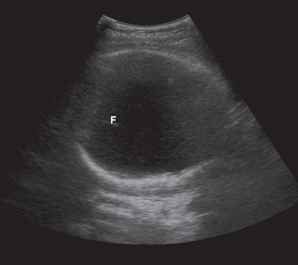 aba023fb-a007-425d-b431-aa1bfad1309f_figure2.gif