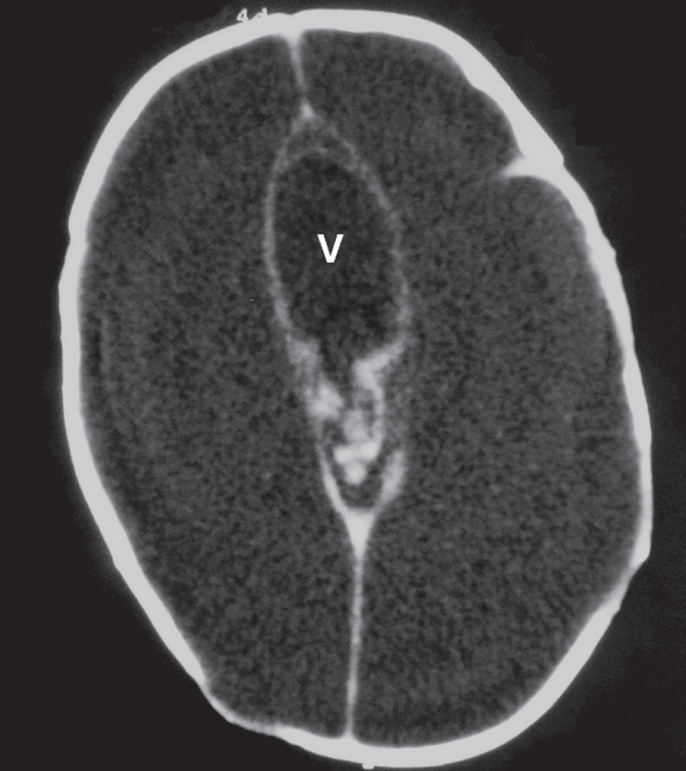 aba023fb-a007-425d-b431-aa1bfad1309f_figure3.gif