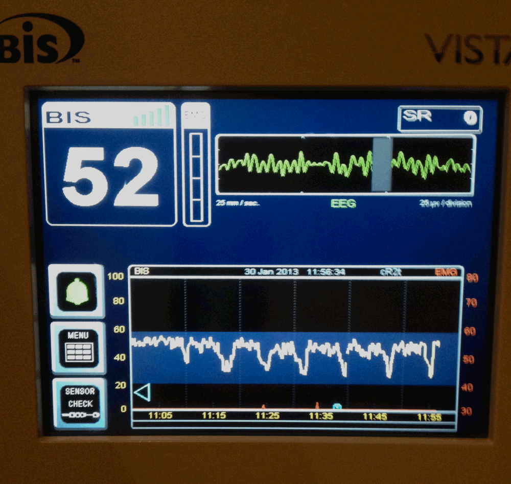 17edde14-9b46-4d14-9d6d-378baa9f9845_figure2.gif