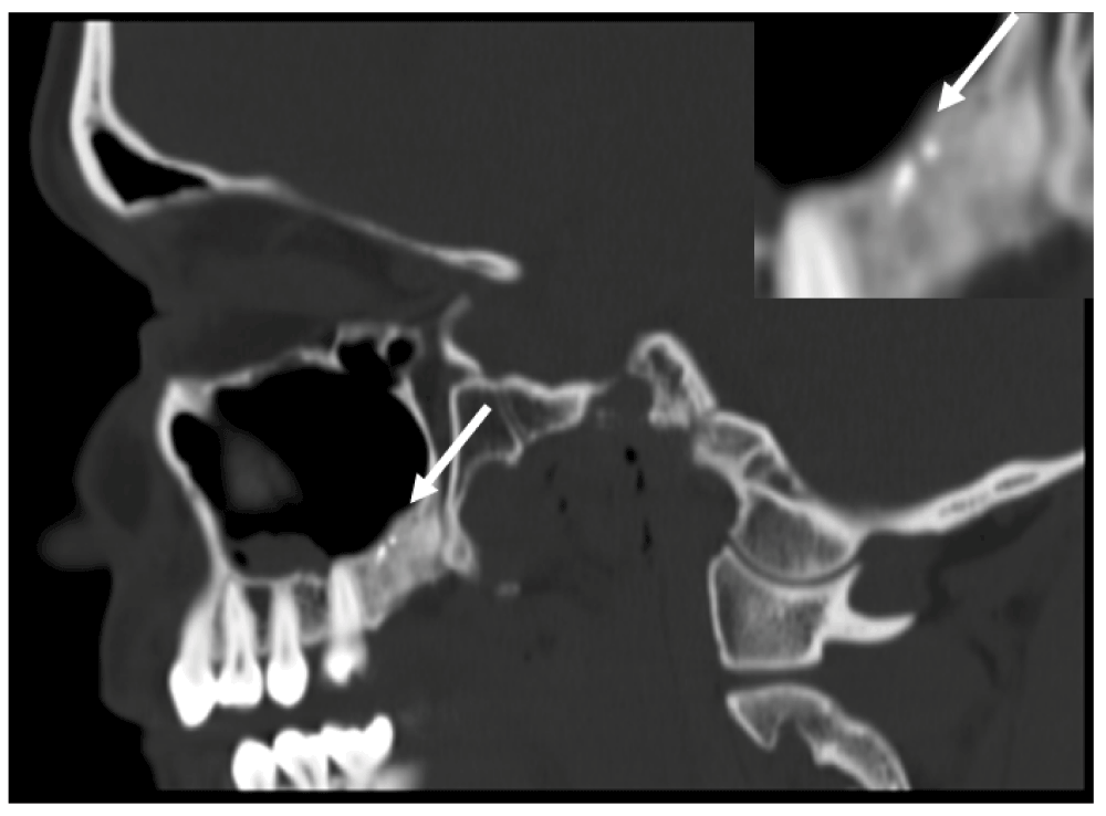 9af85e24-5a2c-4214-b95b-5370352052c0_figure4.gif