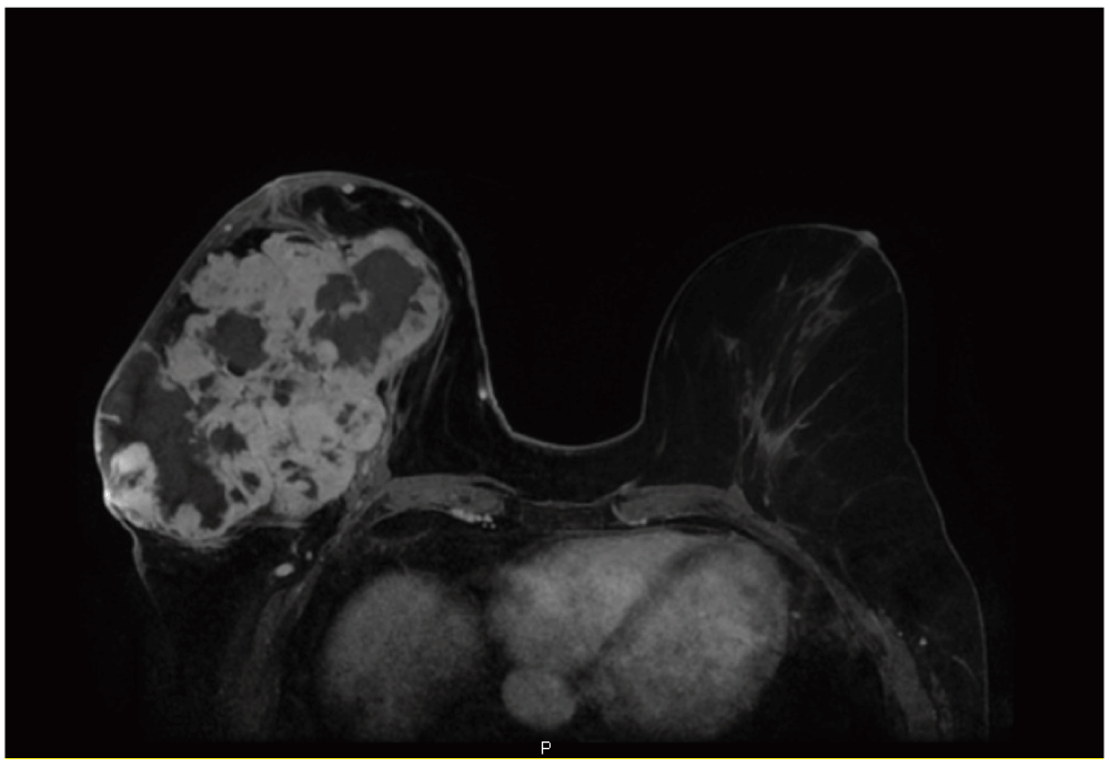 ba116a02-7185-4174-a939-9f7338297777_figure3.gif